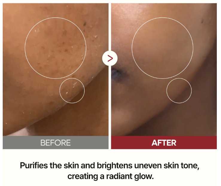 Glowé Rice Glow Shot – Blackhead-Removing Toner Essence